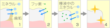 フッ素塗布イメージ画像